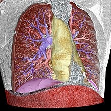 Volume segmentation of a 3D-rendered CT scan of the thorax