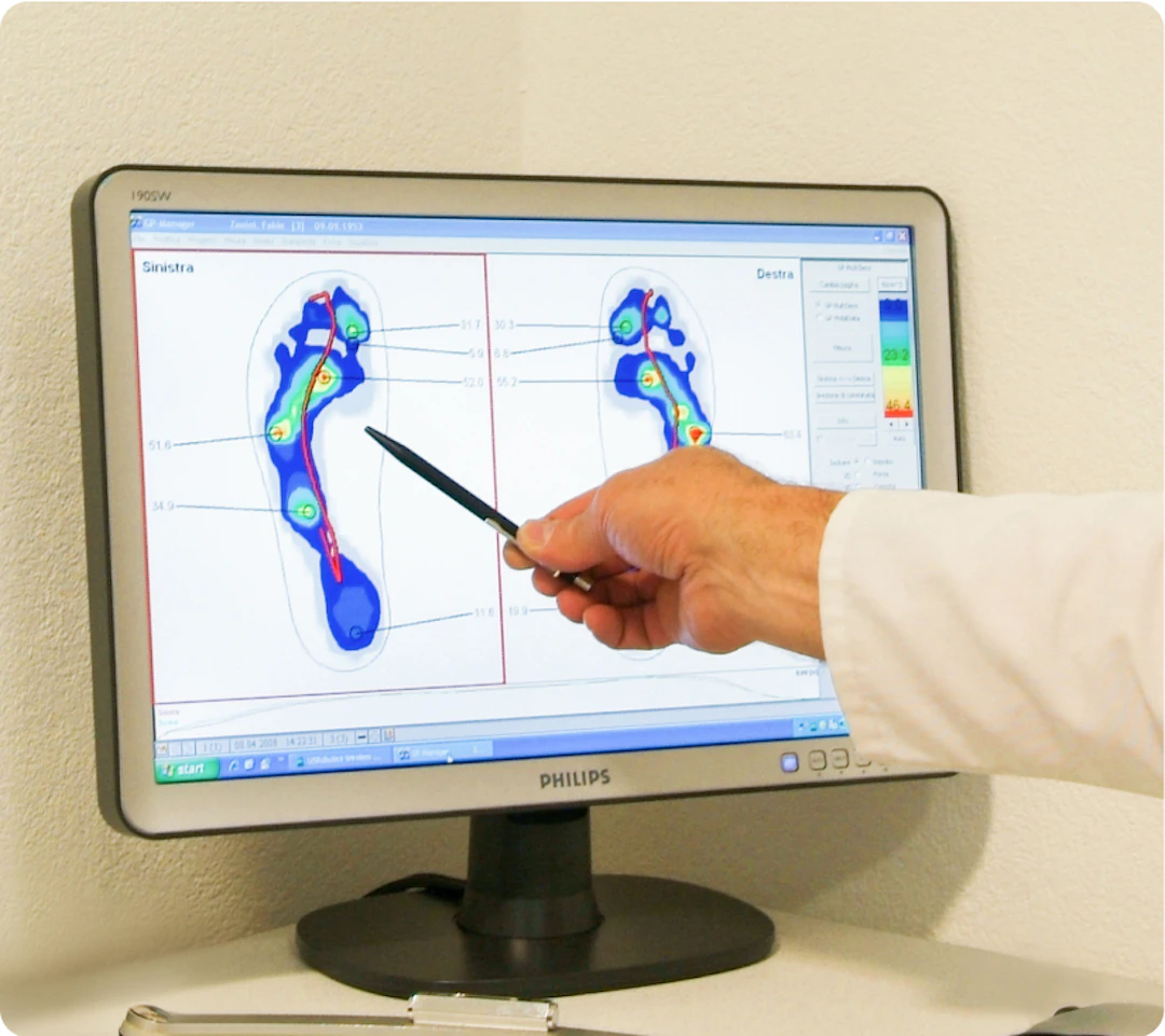 Case study Foot Levelers | Tryolabs